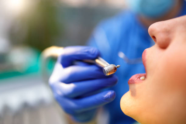 Dental Bonding in Shelby, OH